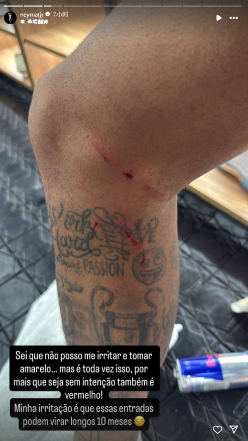 开云体育官网-伤痕累累！刚复出的内马尔晒腿部划痕：每次都可能发生